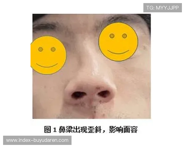 穆罕默德惨败伤情报告:眼眶骨折、鼻梁断裂与唇部撕裂 穆罕默德惨败伤情报告:眼眶骨折、鼻梁断裂与唇部撕裂